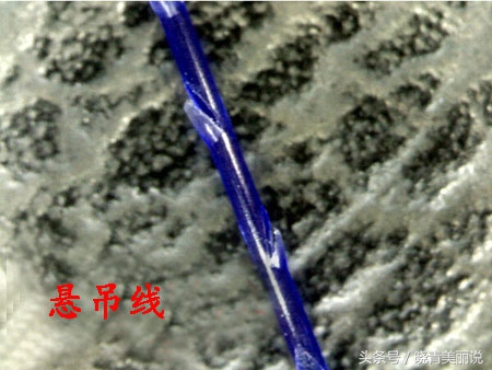 脸垮是先提拉还是填充,脸垮做什么医美没套路