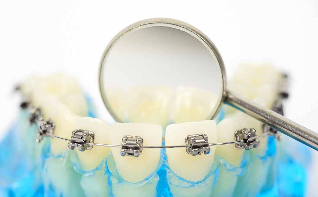 网红脸的标准图,什么是网红脸标准