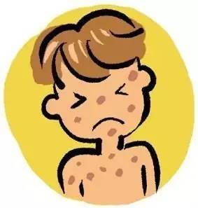 宝宝祛痱止痒的产品有哪些好用的,婴儿祛痱止痒神器