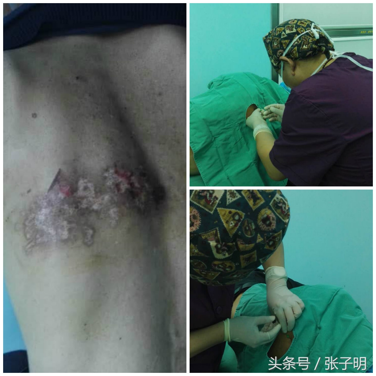 定西市第二人民医院疼痛门诊,李长文医生