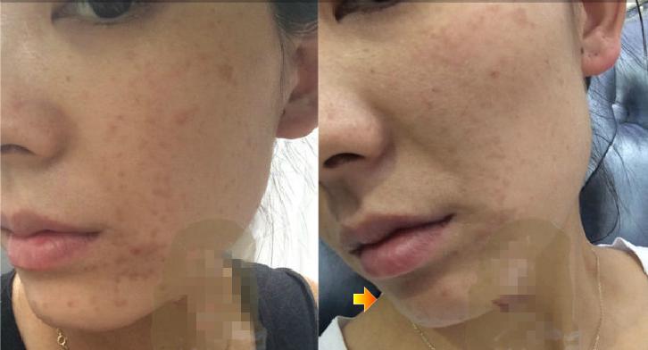 理发师号称养生治疾病，骗女子*款贷**20万办疗程，到底是什么病