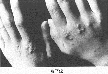 理发师号称养生治疾病，骗女子*款贷**20万办疗程，到底是什么病