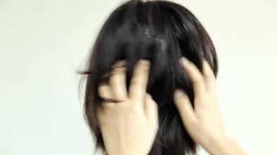 脱发秃发怎么回事,每次洗头掉发正常还是秃了