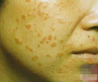 理发师号称养生治疾病，骗女子*款贷**20万办疗程，到底是什么病