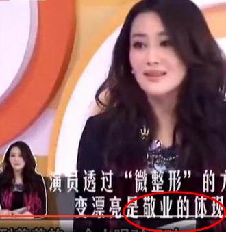 林允回应减肥前后对比,林允是不是整形了