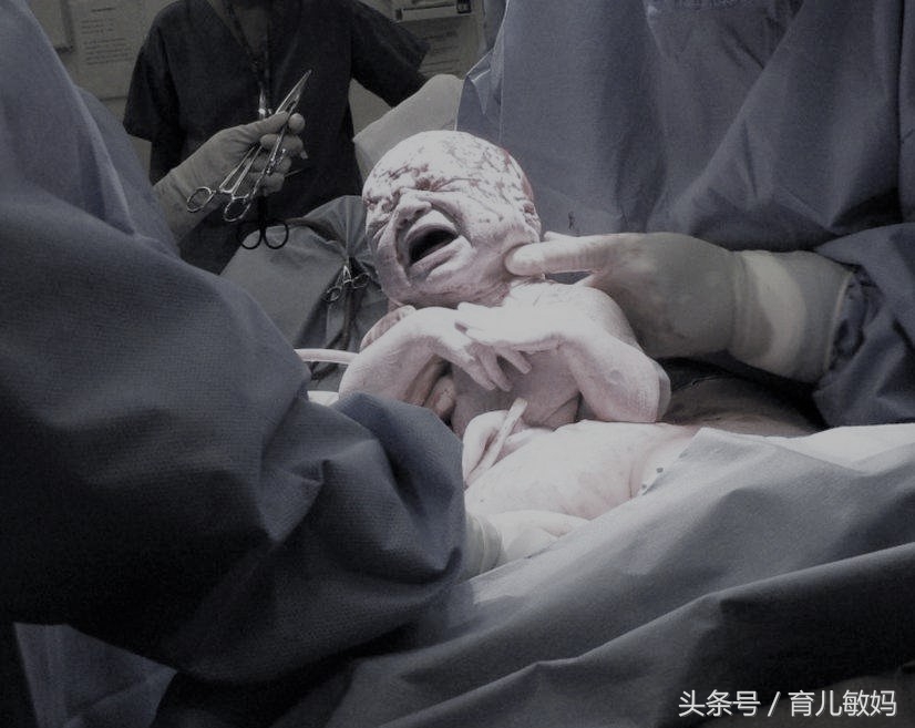 21岁孕妇死活要求剖腹产，医生问出原因后，老公却说这很正常