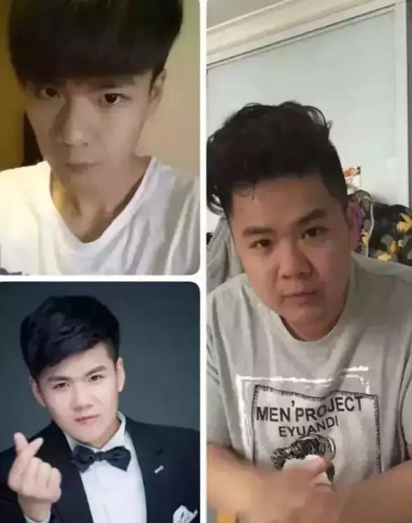 人长胖20斤后对比,长胖20斤会变丑多少