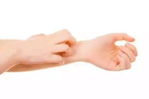 蚊子咬了最有效的止痒方法,蚊子咬了有什么止痒方法
