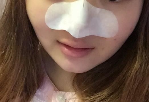 收毛孔去黑头的有效的方法,收毛孔去黑头的有效的小妙招