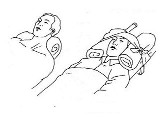 地震急救的基本方法,地震后如何正确急救