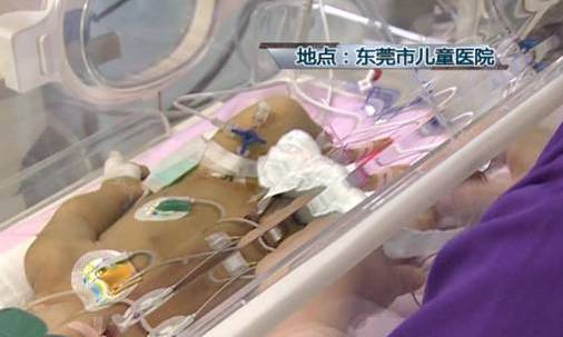 刚出生婴儿满身针孔,婴儿满身针孔性命垂危