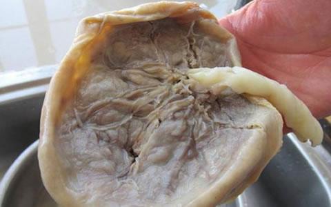 胎盘如何处置最好对孩子好,胎盘如何处置对宝宝好