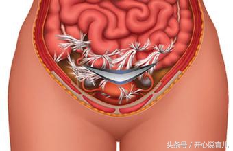 女人一生最多能剖几次产,一胎剖宫产的二胎要不要提前剖