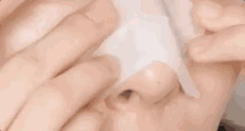 去黑头小妙招你的黑头有救了,别挤了教你去黑头的正确方法