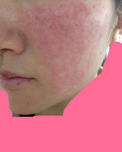 为什么超声做的结果不一样呢,超声刀效果是什么