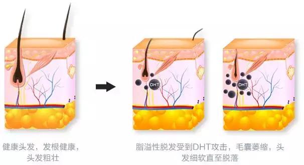 千错万错都是自己的错，亲手毁了自己的头发！