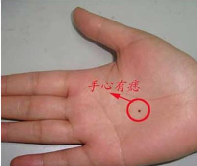 手背有痣的人都有一个怎样的传说,手背上有痣的人有什么说法