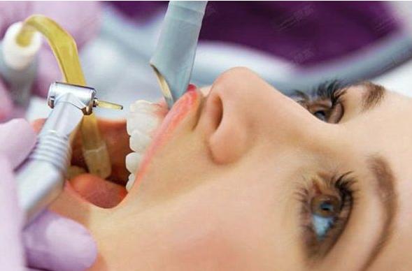 牙周炎牙龈肿胀快速治疗方法,牙周脓肿往牙龈涂什么药