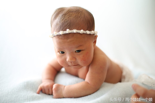 新生儿头皮血肿专家说手术，姥爷说不能碰！宝妈亲历总结7个经验