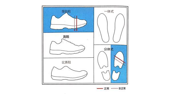 足底筋膜炎康复训练,如何改善脚底筋膜炎