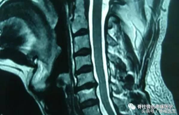 颈椎有点不舒服看什么科,颈椎疼又查不出病根怎么办