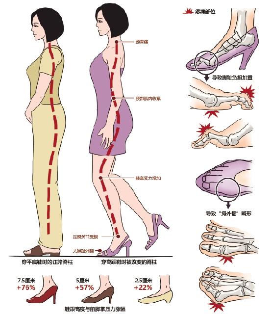 腰痛真的是腰的问题吗,原来这才是腰痛的罪魁祸首