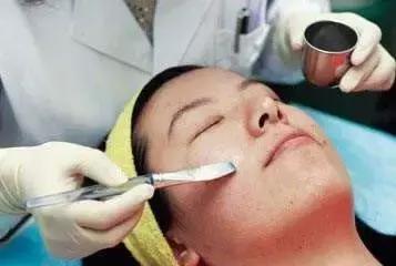 男士脸上黑头粉刺怎么去除,青春期孩子脸上的黑头粉刺怎么办