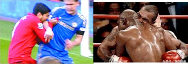 被人咬了，除了让TA赔钱，你还必须这么做！