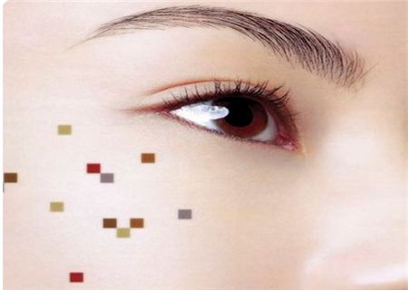 一女子回忆在美容院祛斑有多坑,女子点痣后查出恶性肿瘤