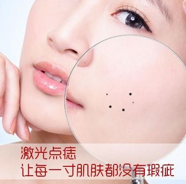 一女子回忆在美容院祛斑有多坑,女子点痣后查出恶性肿瘤