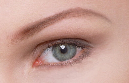 眼皮上长了一颗脂肪粒怎么去除,长在眼皮上的脂肪粒怎么去除