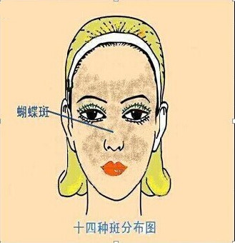 长雀斑要注意的事项,10个防晒小攻略让你告别雀斑