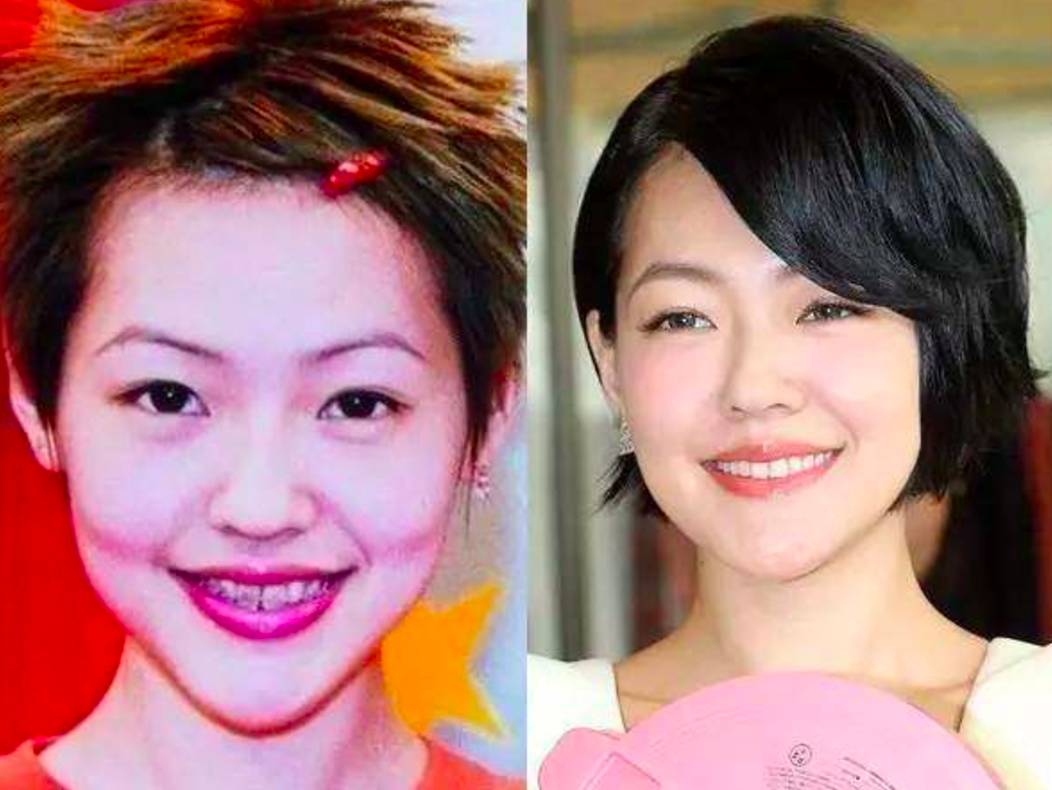 30岁淡化法令纹用什么精华,法令纹严重推荐精华