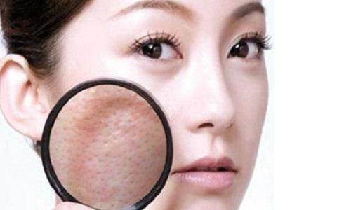 城野医生毛孔护理收敛水200ml,城野医生200ml毛孔收敛水价格