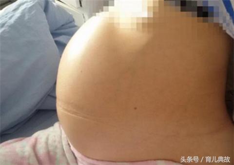 怀孕五月却检查出葡萄胎，这种心痛有谁能懂？