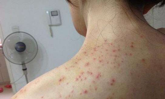 女人脾胃虚湿气重症状,女人湿气重的症状是什么啊