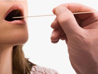 嗓子干痒咳嗽怎么回事是咽炎吗,慢性咽炎很多年了总是喉咙痒咳嗽