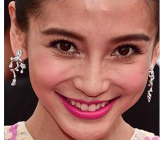 夏天湿气重的症状和表现,民间说身体湿气太重怎样除掉