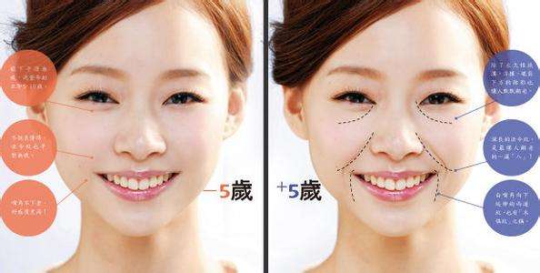 一个小方法轻松改善法令纹女性,一招告别法令纹
