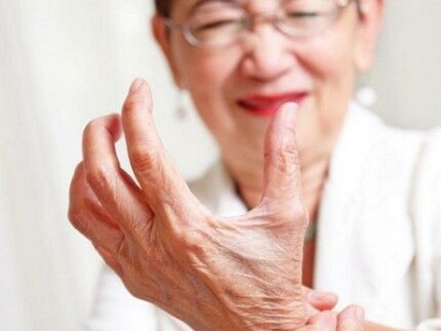 类风湿反复是怎么回事,类风湿怎样才算控制住了不再复发