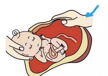 明星剖宫产后为什么能立即下床,女星为何爱剖宫产