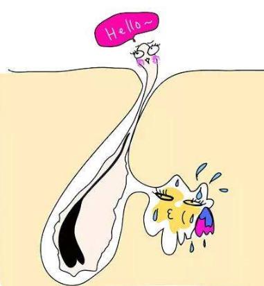 毛发移植一千多钱,毛发移植去哪里靠谱