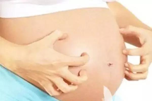 孕期吓到自己会影响胎儿吗,科普孕期痒