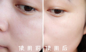 城野医生毛孔收敛水护肤步骤,城野医生毛孔收敛水和兰蔻粉水