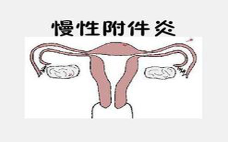 附件炎影响受孕吗,附件炎会影响受孕吗