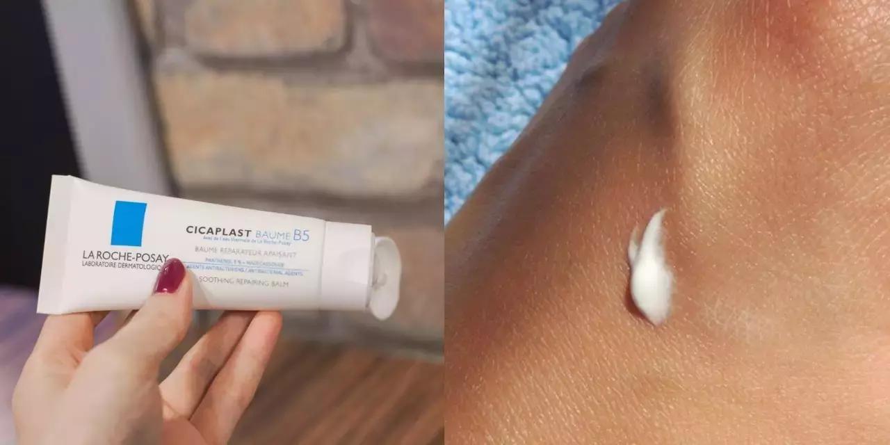 痘印怎么去啊,痘印啊