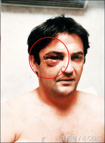 足球场上令人毛骨悚然的受伤场面,足球受伤恐怖瞬间剪辑