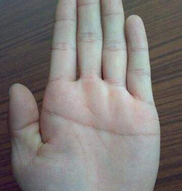 如何分清断掌,如何辨别啥是断掌