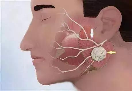 眼皮跳真的是左眼跳财右眼跳灾,眼皮跳是跳财跳灾是真的吗