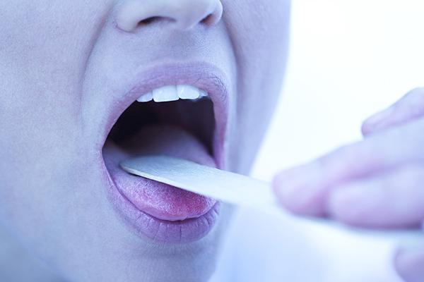 喉咙里经常咳嗽出结石怎么改善,嗓子痒是不是嗓子有结石